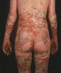 Паразиты в сердце